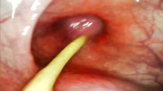 ANAL POV. CAMERA INSIDE HER ASSHOLE AS I POUND HER WITH MY BIG COCK AND CUM DEEP INSIDE